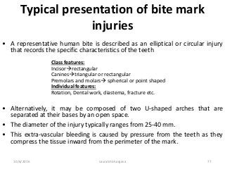 10/6/2016 saurabh bhargava 77
Typical presentation of bite mark
injuries
• A representative human bite is described as an elliptical or circular injury
that records the specific characteristics of the teeth
• Alternatively, it may be composed of two U-shaped arches that are
separated at their bases by an open space.
• The diameter of the injury typically ranges from 25-40 mm.
• This extra-vascular bleeding is caused by pressure from the teeth as they
compress the tissue inward from the perimeter of the mark.
Class features:
Incisorrectangular
Caninestriangular or rectangular
Premolars and molars spherical or point shaped
Individual features:
Rotation, Dental work, diastema, fracture etc.
 