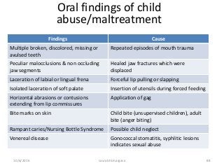 10/6/2016 saurabh bhargava 88
Oral findings of child
abuse/maltreatment
Findings Cause
Multiple broken, discolored, missing or
avulsed teeth
Repeated episodes of mouth trauma
Peculiar malocclusions & non occluding
jaw segments
Healed jaw fractures which were
displaced
Laceration of labial or lingual frena Forceful lip pulling or slapping
Isolated laceration of soft palate Insertion of utensils during forced feeding
Horizontal abrasions or contusions
extending from lip commissures
Application of gag
Bite marks on skin Child bite (unsupervised children), adult
bite (anger biting)
Rampant caries/Nursing Bottle Syndrome Possible child neglect
Venereal disease Gonococcal stomatitis, syphlitic lesions
indicates sexual abuse
 