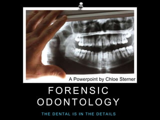 A Powerpoint by Chloe Sterner 
FORENSIC 
ODONTOLOGY 
THE DENTAL IS IN THE DETAI LS 
 