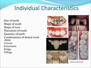 Individual Characteristics
Size of tooth
Shape of tooth
Shape of root
Placement of tooth
Quantity of teeth
Combinations of dental work
done:
Crowns
Extractions
Bridge
Fillings
Various dental work
 