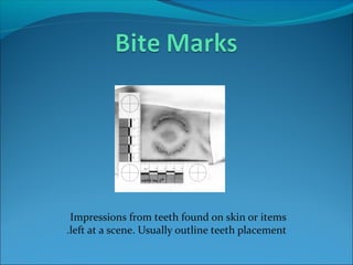 Impressions from teeth found on skin or items
left at a scene. Usually outline teeth placement.
 
