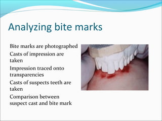 Analyzing bite marks
Bite marks are photographed
Casts of impression are
taken
Impression traced onto
transparencies
Casts of suspects teeth are
taken
Comparison between
suspect cast and bite mark
 