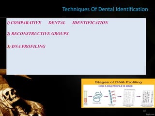 Techniques Of Dental Identification
1) COMPARATIVE DENTAL IDENTIFICATION
2) RECONSTRUCTIVE GROUPS
3) DNA PROFILING
10
 