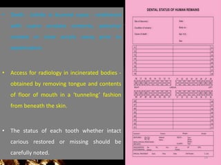 • Teeth - brittle in burned cases - reinforced
with cyano acrylate cements, polyvinyl
acetate or clear acrylic spray prior to
examination.
• Access for radiology in incinerated bodies -
obtained by removing tongue and contents
of floor of mouth in a ‘tunneling’ fashion
from beneath the skin.
• The status of each tooth whether intact
carious restored or missing should be
carefully noted.
14
 