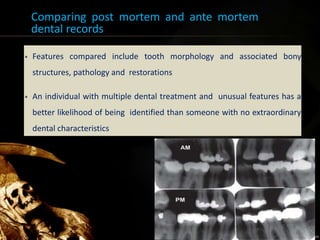 Comparing post mortem and ante mortem
dental records
• Features compared include tooth morphology and associated bony
structures, pathology and restorations
• An individual with multiple dental treatment and unusual features has a
better likelihood of being identified than someone with no extraordinary
dental characteristics
16
 