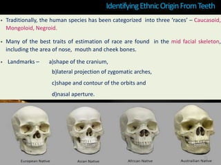 IdentifyingEthnicOriginFromTeeth
• Traditionally, the human species has been categorized into three ‘races’ – Caucasoid,
Mongoloid, Negroid.
• Many of the best traits of estimation of race are found in the mid facial skeleton,
including the area of nose, mouth and cheek bones.
• Landmarks – a)shape of the cranium,
b)lateral projection of zygomatic arches,
c)shape and contour of the orbits and
d)nasal aperture.
31
 