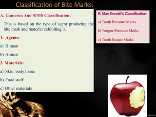 Classification of Bite Marks:
A. Cameron And SIMS Classification:
This is based on the type of agent producing the
bite mark and material exhibiting it.
1. Agents:
a) Human
b) Animal
2. Materials:
a) Skin, body tissue
b) Food stuff
c) Other materials
B.Mac Donald’s Classification:
a) Tooth Pressure Marks
b) Tongue Pressure Marks
c) Tooth Scrape Marks
51
 