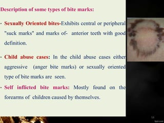 Description of some types of bite marks:
• Sexually Oriented bites-Exhibits central or peripheral
"suck marks" and marks of- anterior teeth with good
definition.
• Child abuse cases: In the child abuse cases either
aggressive (anger bite marks) or sexually oriented
type of bite marks are seen.
• Self inflicted bite marks: Mostly found on the
forearms of children caused by themselves.
53
 