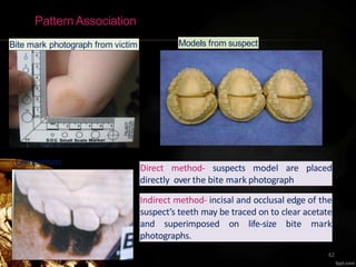 PatternAssociation
Bite mark photograph from victim Models from suspect
Comparison
Direct method- suspects model are placed
directly over the bite mark photograph
Indirect method- incisal and occlusal edge of the
suspect’s teeth may be traced on to clear acetate
and superimposed on life-size bite mark
photographs.
62
 