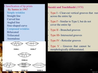 Classification of lip prints
By Santos in 1967
Simple wrinkles
Straight line
Curved line
Angled line
Sine-shaped curve
Compound wrinkles
Bifurcated
Trifurcated
Anomalous
Suzuki and Tsuchihashi (1970)
• Type I - Clear-cut vertical grooves that run
across the entire lip
• Type I' - Similar to Type I, but do not
cover the entire lip
• Type II - Branched grooves
• Type III- Intersected grooves
• Type IV - Reticular grooves
• Type V - Grooves that cannot be
morphologically differentiated.
66
 