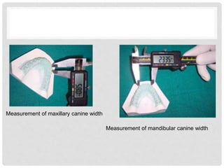 Measurement of maxillary canine width
Measurement of mandibular canine width
 