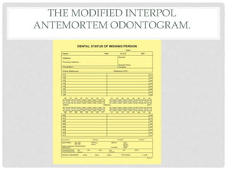 THE MODIFIED INTERPOL
ANTEMORTEM ODONTOGRAM.
 