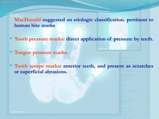 MacDonald suggested an etiologic classification. pertinent to
human bite marks
 Tooth pressure marks: direct application of pressure by teeth.
 Tongue pressure marks.
 Tooth scrape marks: anterior teeth, and present as scratches
or superficial abrasions.
 
