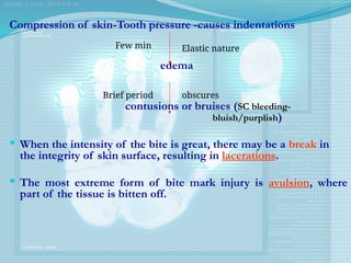 Compression of skin-Tooth pressure -causes indentations
edema
contusions or bruises (SC bleeding-
bluish/purplish)
 When the intensity of the bite is great, there may be a break in
the integrity of skin surface, resulting in lacerations.
 The most extreme form of bite mark injury is avulsion, where
part of the tissue is bitten off.
Few min Elastic nature
Brief period obscures
 