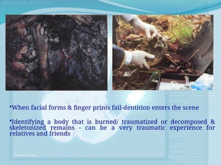 •When facial forms & finger prints fail-dentition enters the scene
•Identifying a body that is burned/ traumatized or decomposed &
skeletonized remains - can be a very traumatic experience for
relatives and friends
 