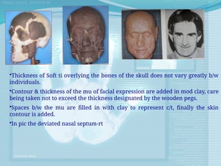 •Thickness of Soft ti overlying the bones of the skull does not vary greatly b/w
individuals.
•Contour & thickness of the mu of facial expression are added in mod clay, care
being taken not to exceed the thickness designated by the wooden pegs.
•Spaces b/w the mu are filled in with clay to represent c/t, finally the skin
contour is added.
•In pic the deviated nasal septum-rt
 