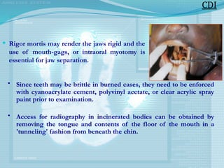  Rigor mortis may render the jaws rigid and the
use of mouth-gags, or intraoral myotomy is
essential for jaw separation.
CDI
• Since teeth may be brittle in burned cases, they need to be enforced
with cyanoacrylate cement, polyvinyl acetate, or clear acrylic spray
paint prior to examination.
• Access for radiography in incinerated bodies can be obtained by
removing the tongue and contents of the floor of the mouth in a
'tunneling' fashion from beneath the chin.
 