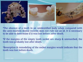 •The absence of a tooth in an unidentified body when compared with
the ante-mortem dental records does not rule out an id. It is necessary
to be able to determine if it was lost before /after death.
•If the margins of the empty tooth socket are sharp & unresorbed, the
tooth was probably lost after death.
•Resorption & remodeling of the socket margins would indicate that the
tooth was lost before death.
 
