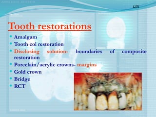 Tooth restorations
 Amalgam
 Tooth col restoration
 Disclosing solution- boundaries of composite
restoration
 Porcelain/acrylic crowns- margins
 Gold crown
 Bridge
 RCT
CDI
 