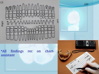 •All findings rec on chart-
assistant
CDI
 