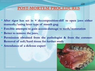 POST-MORTEM PROCEDURES
 After rigor has set in + decomposition-diff to open jaws either
manually/using lever type of mouth gag.
 Forcible attempts to gain access-damage to teeth/restoration
 Better to remove the jaws.
 Permission obtained from the pathologist & from the coroner-
Removal of soft/hard tissue for further study
 Attendance of a defense expert
CDI
 
