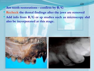  Ant tooth restorations - confirm by R/G
 Recheck the dental findings after the jaws are removed
 Add info from R/G or sp studies such as microscopy shd
also be incorporated at this stage.
CDI
 