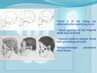 •Facial # of the living are
reflected in the underlying sk str.
• Nasal aperture of the Negroid
skulls may be broad.
• Negroid palate-u shaped, broad
with protruding ant teeth.
•Mongoloid-larger prominent
cheek bones.
 