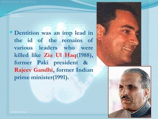  Dentition was an imp lead in
the id of the remains of
various leaders who were
killed like Zia Ul Haq(1988),
former Paki president &
Rajeev Gandhi, former Indian
prime minister(1991).
 