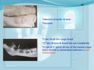 •Absence of teeth-<6 mon
•Variable
•1 dec M-all the cusps fused
•2nd
dec M-min & fused but not completely
•Crypt of 1st
perm M-one of the mesial cusps
have started to mineralize indicates a new
born infant.
DP
 
