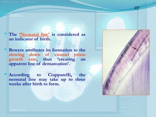  The ‘Neonatal line' is considered as
an indicator of birth.
 Bowers attributes its formation to the
slowing down of enamel prism
growth rate, thus ‘creating an
apparent line of demarcation’.
 According to CiapparelIi, the
neonatal line may take up to three
weeks after birth to form.
DP
 