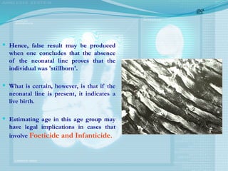  Hence, false result may be produced
when one concludes that the absence
of the neonatal line proves that the
individual was 'stilIborn'.
 What is certain, however, is that if the
neonatal line is present, it indicates a
live birth.
 Estimating age in this age group may
have legal implications in cases that
involve Foeticide and Infanticide.
DP
 