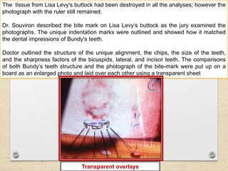 The tissue from Lisa Levy's buttock had been destroyed in all the analyses; however the
photograph with the ruler still remained.
Dr. Souviron described the bite mark on Lisa Levy’s buttock as the jury examined the
photographs. The unique indentation marks were outlined and showed how it matched
the dental impressions of Bundy's teeth.
Doctor outlined the structure of the unique alignment, the chips, the size of the teeth,
and the sharpness factors of the bicuspids, lateral, and incisor teeth. The comparisons
of both Bundy’s teeth structure and the photograph of the bite-mark were put up on a
board as an enlarged photo and laid over each other using a transparent sheet
Transparent overlays
 