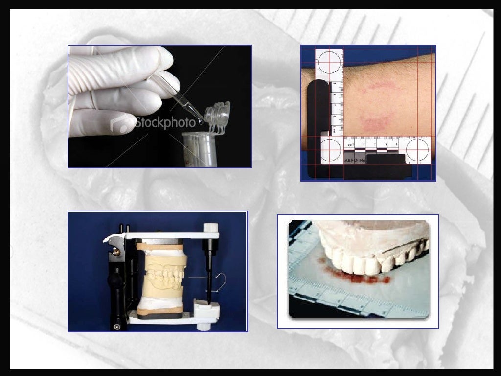 Forensic Odontology Dentistry