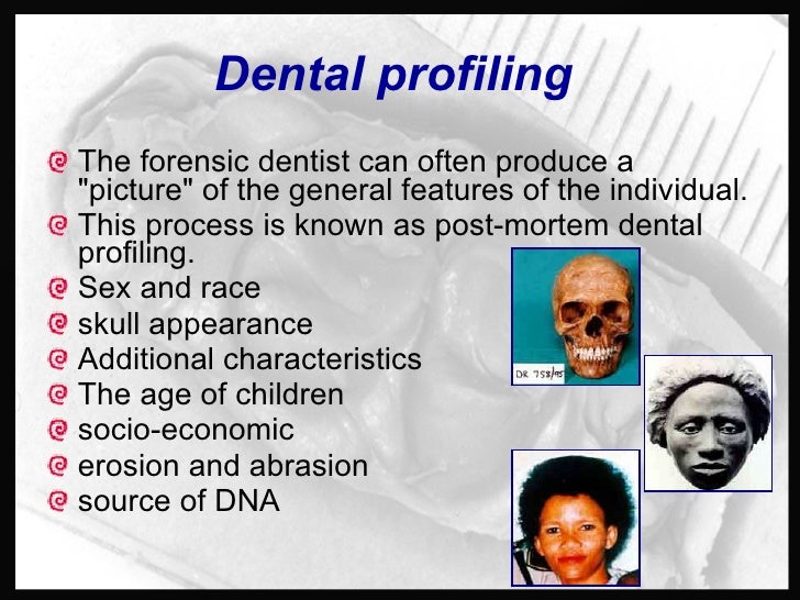 Forensic Odontology Dentistry