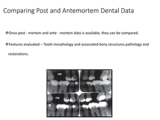 Forensic odontology part 1 | PPTX