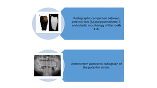 Forensic odontology part 2 | PPTX