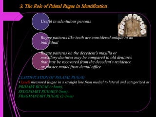3. The Role of Palatal Rugae in Identification
Useful in edentulous persons
Rugae patterns like teeth are considered unique to an
individual
Rugae patterns on the decedent's maxilla or
maxillary dentures may be compared to old dentures
that may be recovered from the decedent's residence
or plaster model from dental office
CLASSIFICATION OF PALATAL RUGAE-
• Lysell measured Rugae in a straight line from medial to lateral and categorized as
PRIMARY RUGAE (>5mm),
SECONDARY RUGAE(3-5mm),
FRAGMANTARY RUGAE (2-3mm)
 