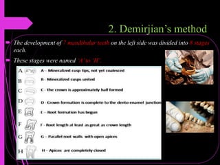 2. Demirjian’s method
 The development of 7 mandibular teeth on the left side was divided into 8 stages
each.
 These stages were named ‘A’to ‘H’.
 