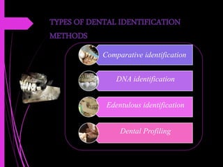 TYPES OF DENTAL IDENTIFICATION
METHODS
Comparative identification
DNA identification
Edentulous identification
Dental Profiling
 
