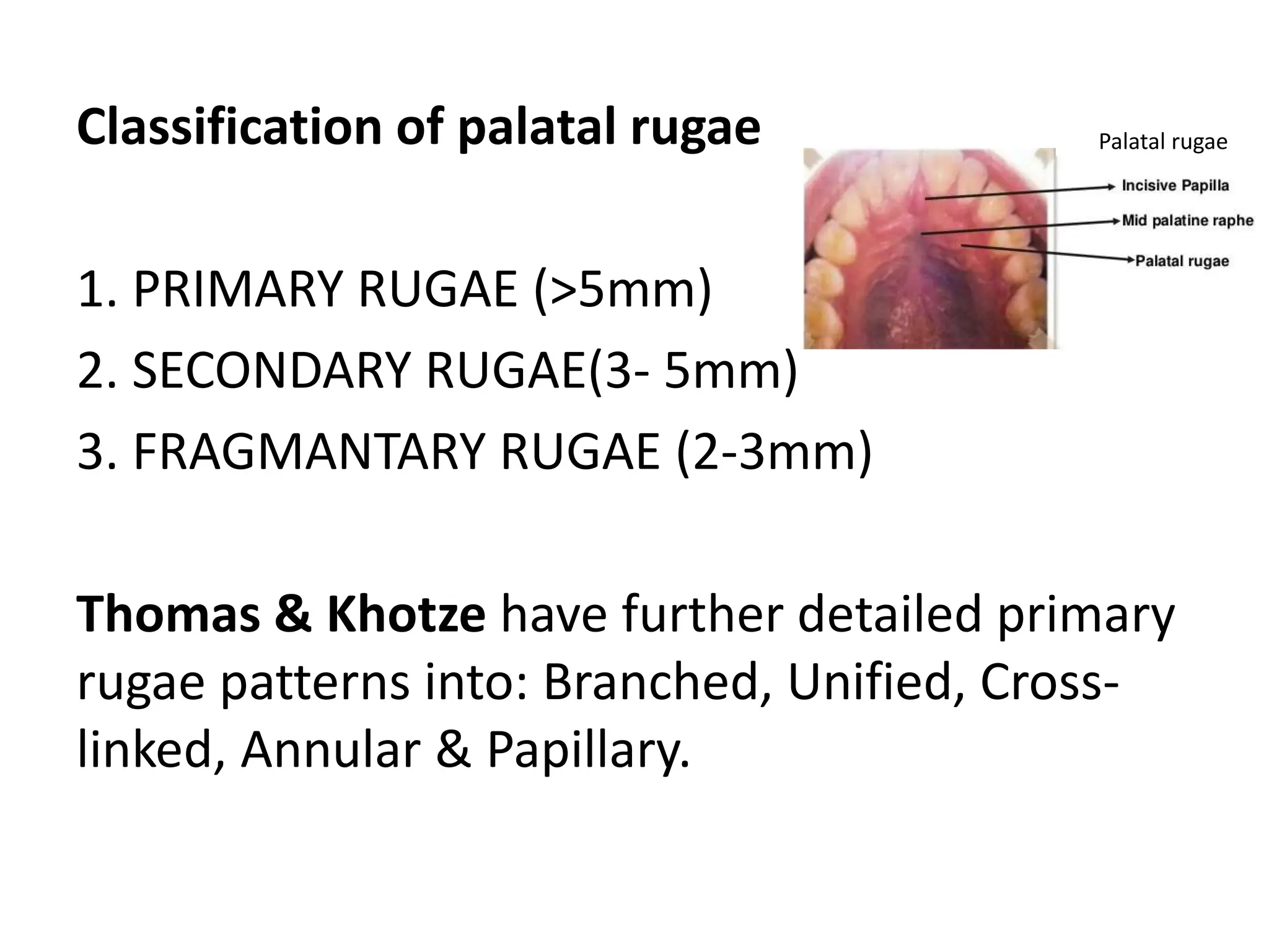 Classification of palatal rugae
1. PRIMARY RUGAE (>5mm)
2. SECONDARY RUGAE(3- 5mm)
3. FRAGMANTARY RUGAE (2-3mm)
Thomas & Khotze have further detailed primary
rugae patterns into: Branched, Unified, Cross-
linked, Annular & Papillary.
Palatal rugae
 