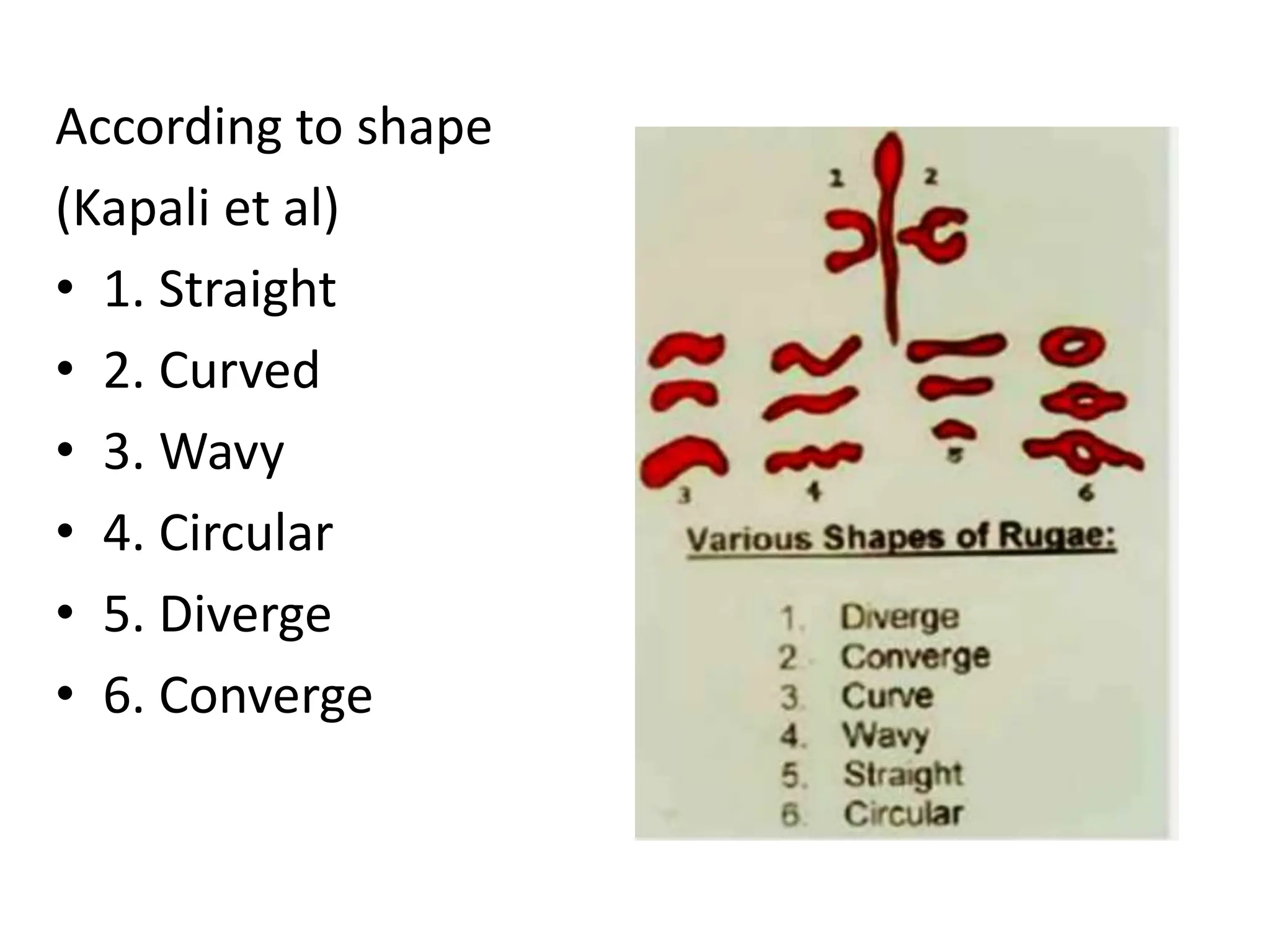According to shape
(Kapali et al)
• 1. Straight
• 2. Curved
• 3. Wavy
• 4. Circular
• 5. Diverge
• 6. Converge
 