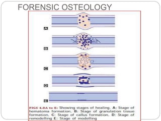 Forensic osteology Slide 25