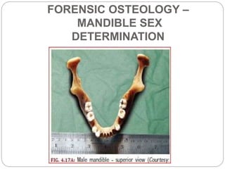 FORENSIC OSTEOLOGY –
MANDIBLE SEX DETERMINATION
.
Sex
The differences between male and female in mandible are
described in...