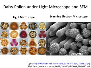 Daisy Pollen under Light Microscope and SEM

     Light Microscope               Scanning Electron Microscope




               Light: http://www.abc.net.au/reslib/201110/r841964_7864873.jpg
               SEM: http://www.abc.net.au/reslib/201110/r842009_7866030.JPG
 