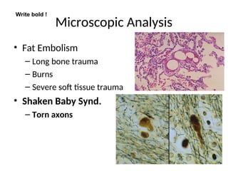 Microscopic Analysis
• Fat Embolism
– Long bone trauma
– Burns
– Severe soft tissue trauma
• Shaken Baby Synd.
– Torn axons
Write bold !
 