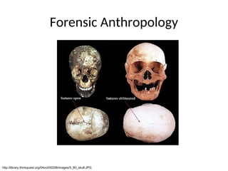 Forensic Anthropology
http://library.thinkquest.org/04oct/00206/images/5_60_skull.JPG
 
