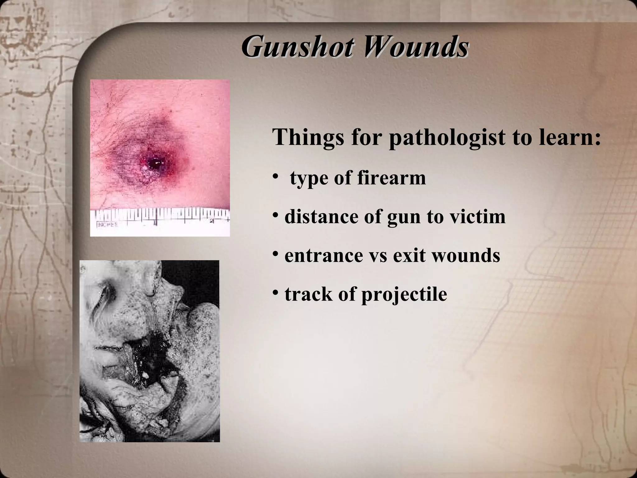 Gunshot WoundsGunshot Wounds
Things for pathologist to learn:
• type of firearm
• distance of gun to victim
• entrance vs exit wounds
• track of projectile
 