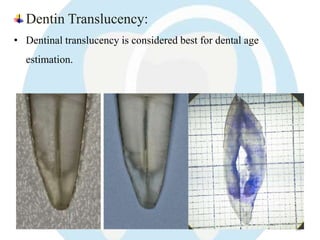 Translucent Dentin Forensic prosthodontics | PPTX