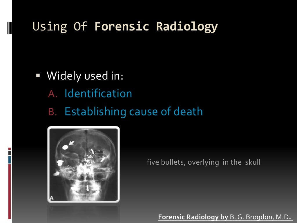 Forensic Radiography