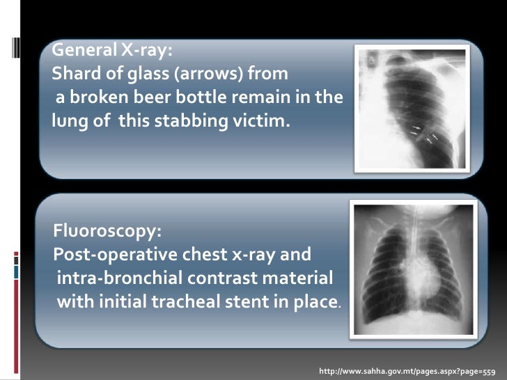 Forensic Radiography